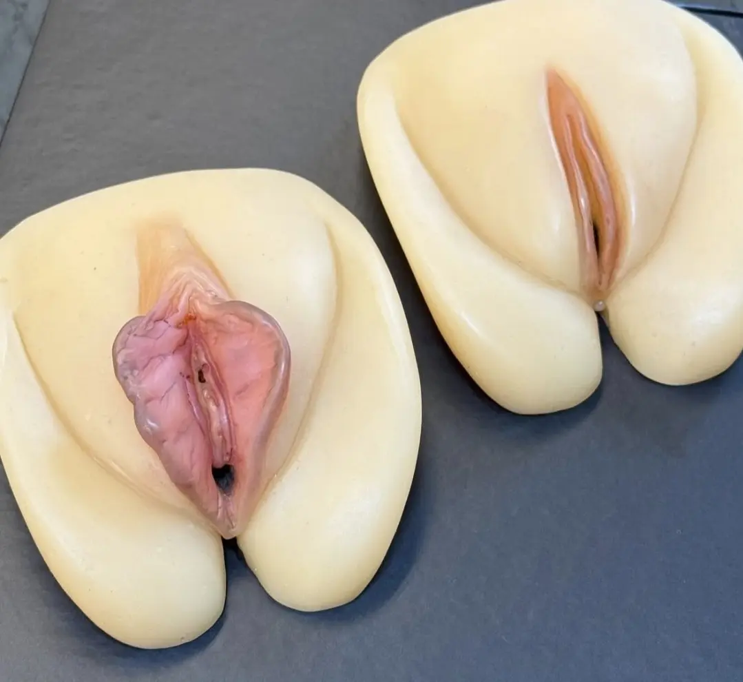 Modelos anatômicos usados para explicar a ninfoplastia